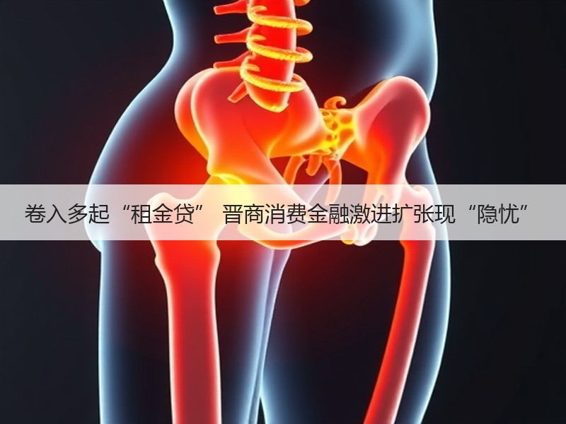 卷入多起“租金贷” 晋商消费金融激进扩张现“隐忧”